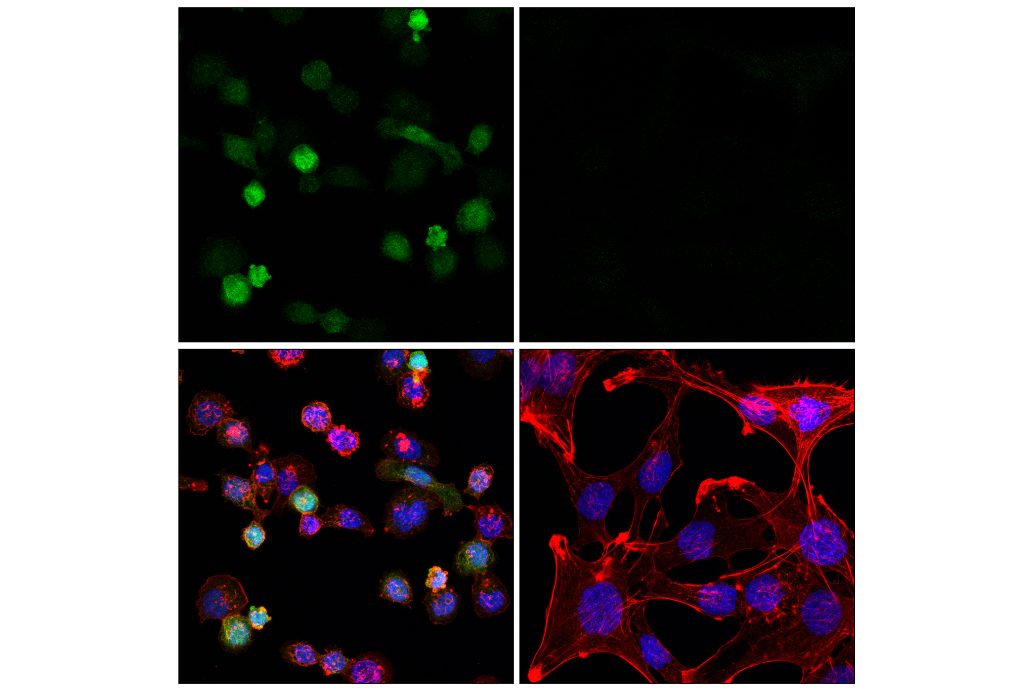 Immunofluorescence Image 1: p47phox (F3Y6C) Rabbit mAb (BSA and Azide Free)
