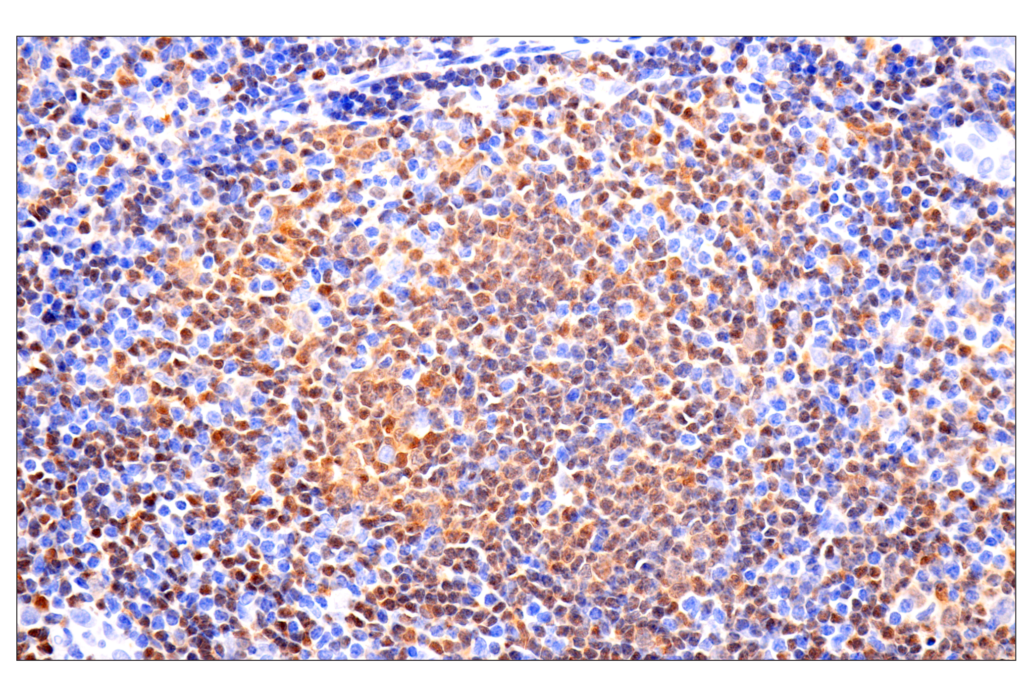 Immunohistochemistry Image 2: p47phox (F3Y6C) Rabbit mAb (BSA and Azide Free)
