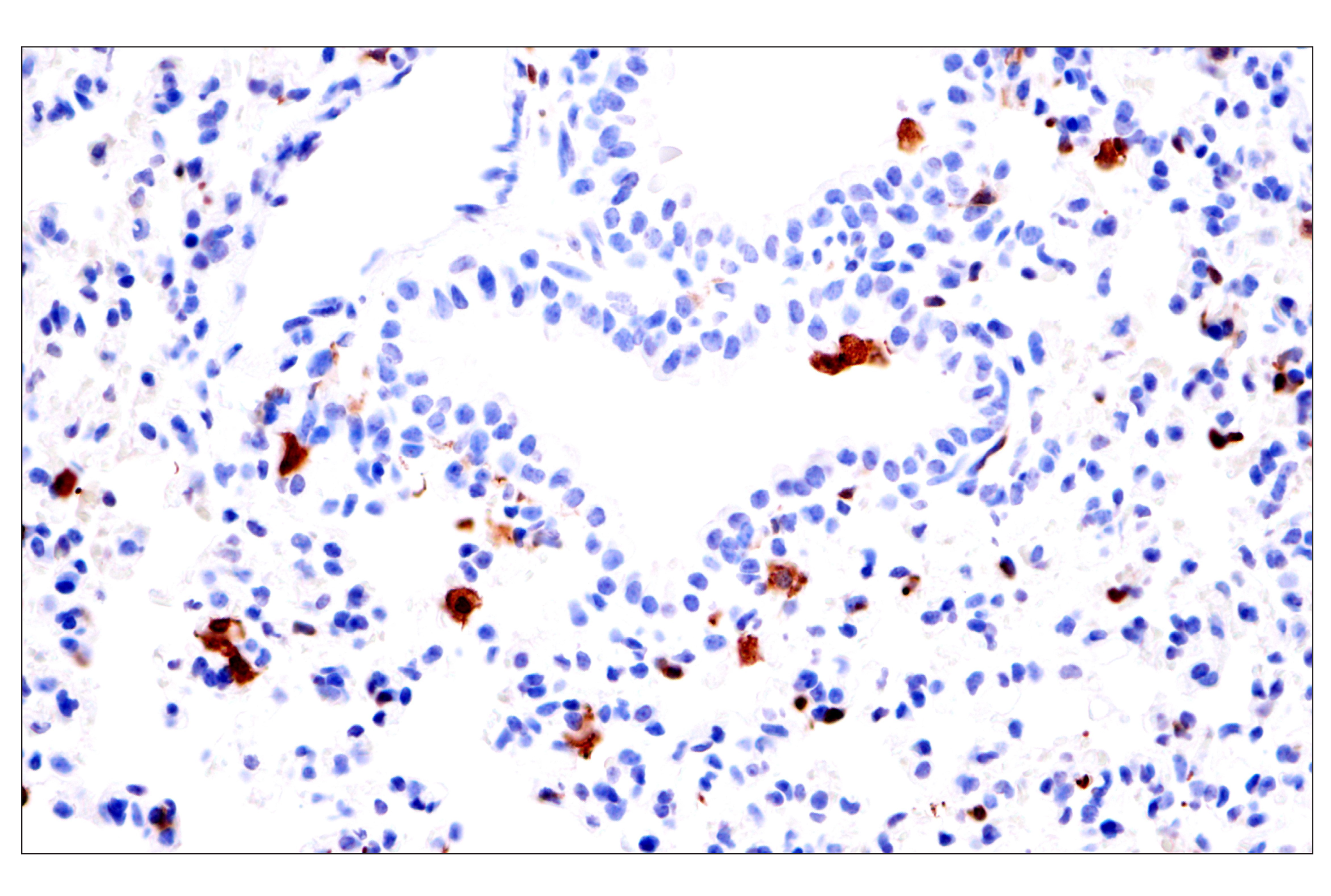 Immunohistochemistry Image 10: p47phox (F3Y6C) Rabbit mAb (BSA and Azide Free)