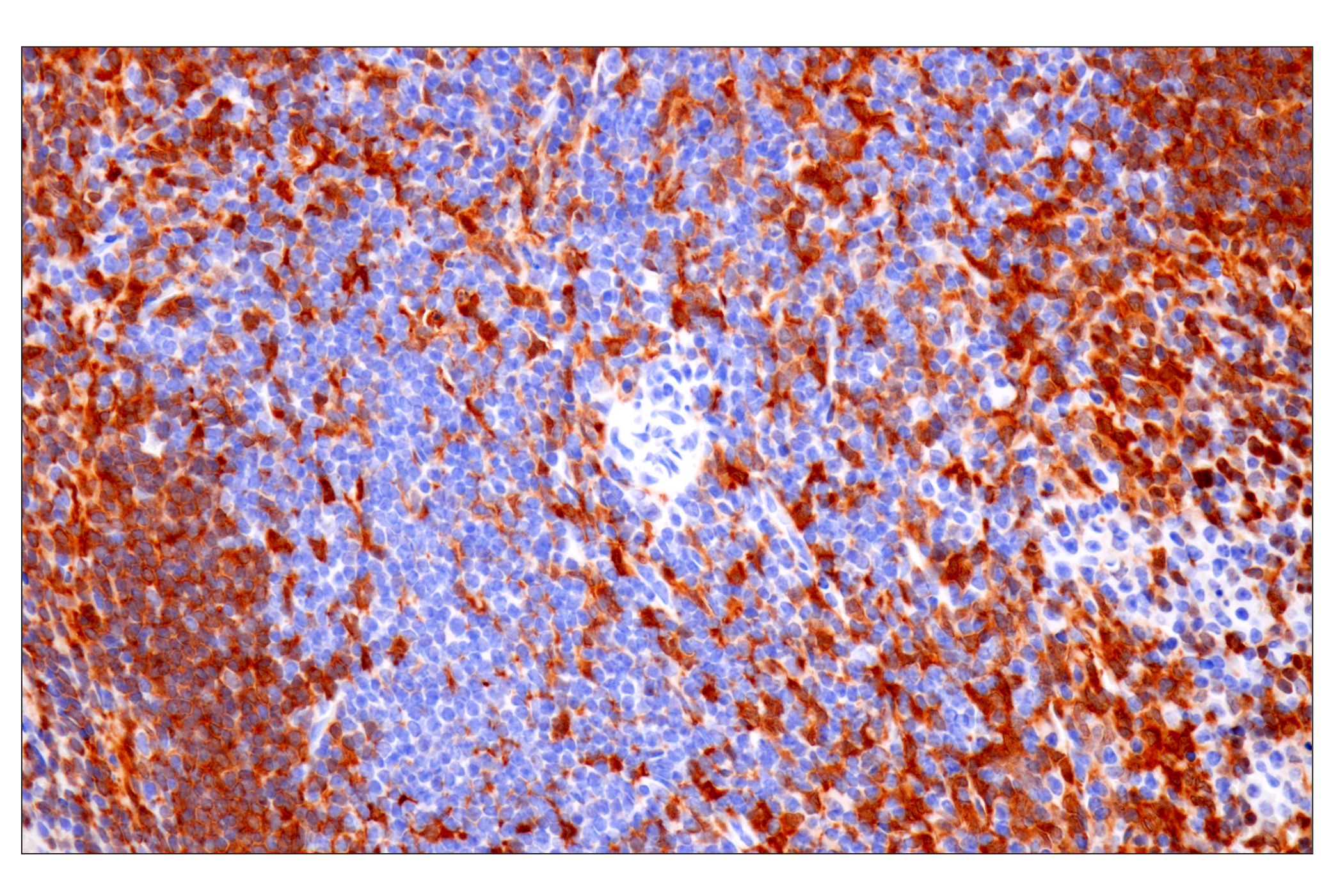 Immunohistochemistry Image 8: p47phox (F3Y6C) Rabbit mAb (BSA and Azide Free)