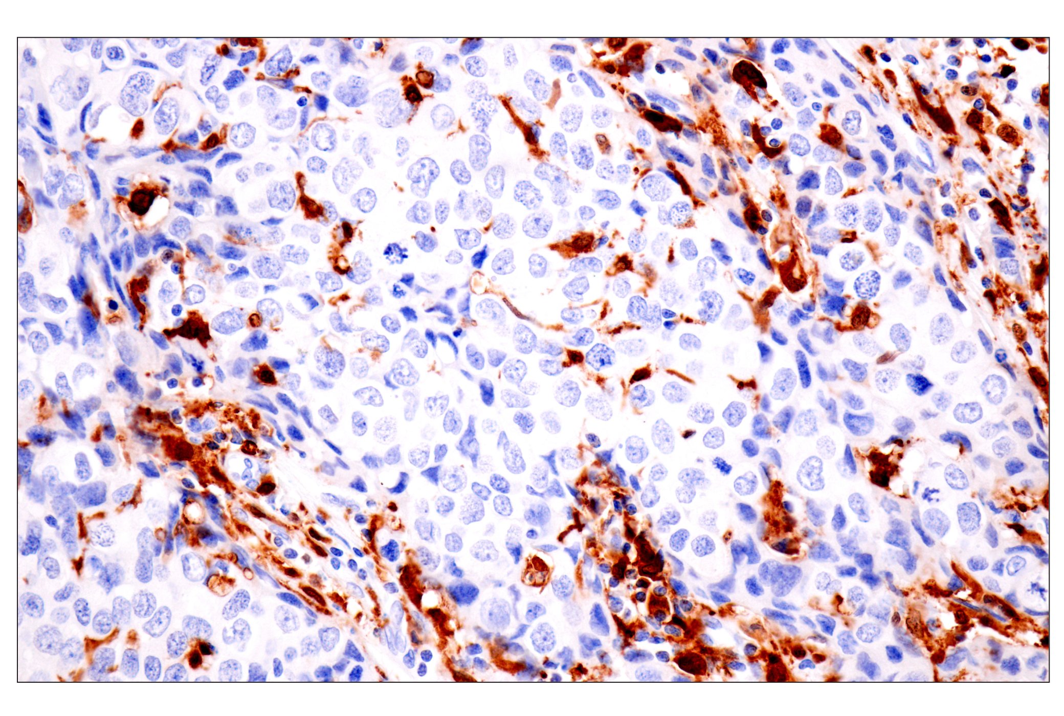 Immunohistochemistry Image 3: p47phox (F3Y6C) Rabbit mAb (BSA and Azide Free)