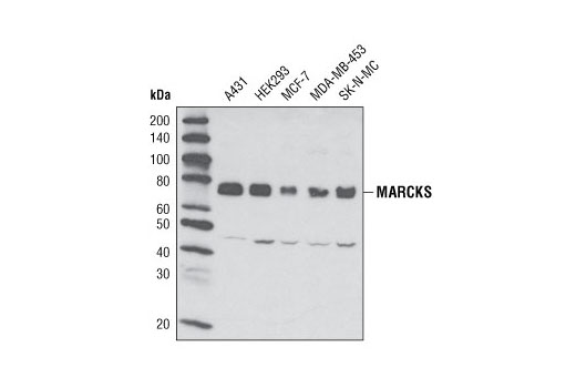 Western Blotting Image 1: MARCKS (D88D11) XP® Rabbit mAb (BSA and Azide Free)
