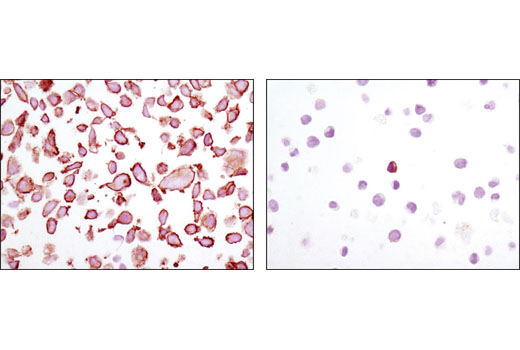 Immunohistochemistry Image 3: MARCKS (D88D11) XP® Rabbit mAb (BSA and Azide Free)