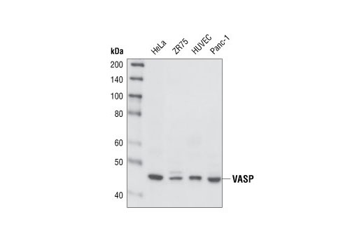 Western Blotting Image 1: VASP (A290) Antibody