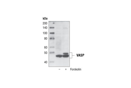 Western Blotting Image 2: VASP (A290) Antibody
