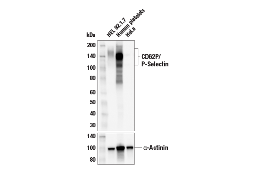 Western Blotting Image 1: CD62P/P-Selectin (E8Q1W) XP® Rabbit mAb (BSA and Azide Free)