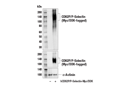 Western Blotting Image 2: CD62P/P-Selectin (E8Q1W) XP® Rabbit mAb (BSA and Azide Free)