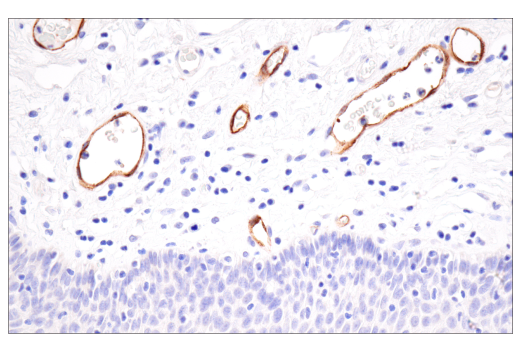Immunohistochemistry Image 9: CD62P/P-Selectin (E8Q1W) XP® Rabbit mAb (BSA and Azide Free)