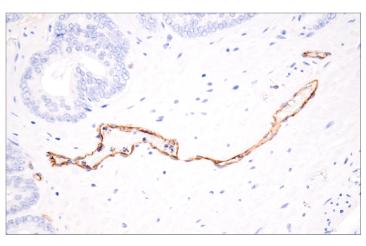 Immunohistochemistry Image 6: CD62P/P-Selectin (E8Q1W) XP® Rabbit mAb (BSA and Azide Free)