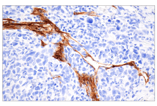 Immunohistochemistry Image 2: CD62P/P-Selectin (E8Q1W) XP® Rabbit mAb (BSA and Azide Free)