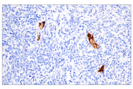 Immunohistochemistry Image 4: CD62P/P-Selectin (E8Q1W) XP® Rabbit mAb (BSA and Azide Free)