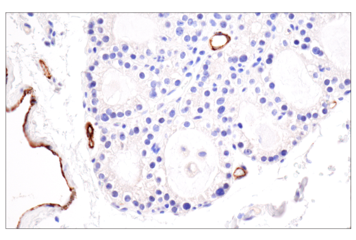 Immunohistochemistry Image 11: CD62P/P-Selectin (E8Q1W) XP® Rabbit mAb (BSA and Azide Free)