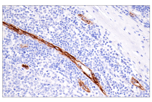 Immunohistochemistry Image 8: CD62P/P-Selectin (E8Q1W) XP® Rabbit mAb (BSA and Azide Free)