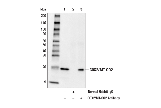 Immunoprecipitation Image 1: COX2/MT-CO2 Antibody