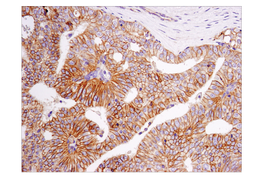 Immunohistochemistry Image 3: PVR/CD155 (D8A5G) Rabbit mAb (BSA and Azide Free)