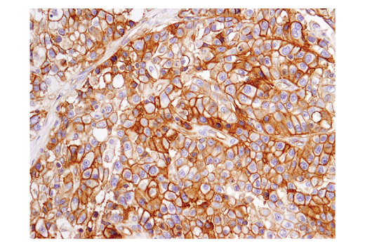 Immunohistochemistry Image 2: PVR/CD155 (D8A5G) Rabbit mAb (BSA and Azide Free)
