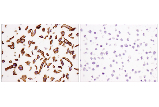 Immunohistochemistry Image 4: PVR/CD155 (D8A5G) Rabbit mAb (BSA and Azide Free)