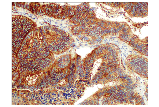 Immunohistochemistry Image 1: PVR/CD155 (D8A5G) Rabbit mAb (BSA and Azide Free)