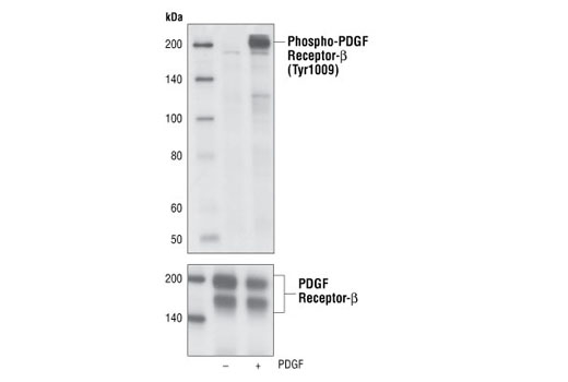  Image 2: PDGF Receptor β Antibody Sampler Kit