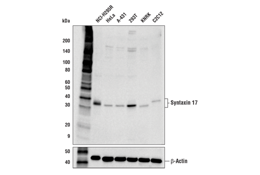 Western Blotting Image 1: Syntaxin 17 (D3D7H) Rabbit mAb