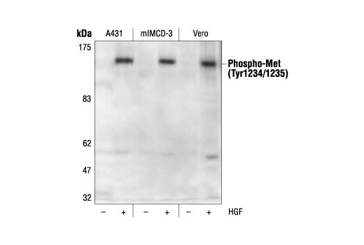 Western Blotting Image 1: Phospho-Met (Tyr1234/1235) Antibody