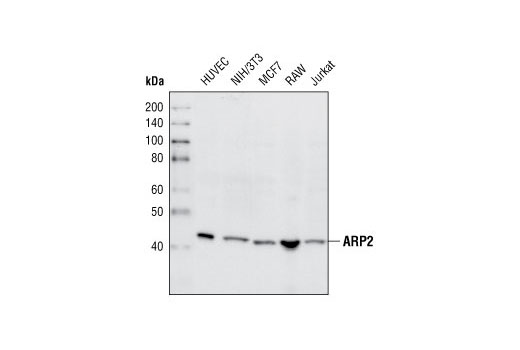  Image 2: Actin Nucleation and Polymerization Antibody Sampler Kit