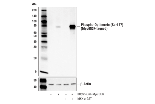  Image 1: PhosphoPlus® Optineurin (Ser177) Antibody Duet
