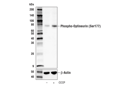  Image 3: PhosphoPlus® Optineurin (Ser177) Antibody Duet