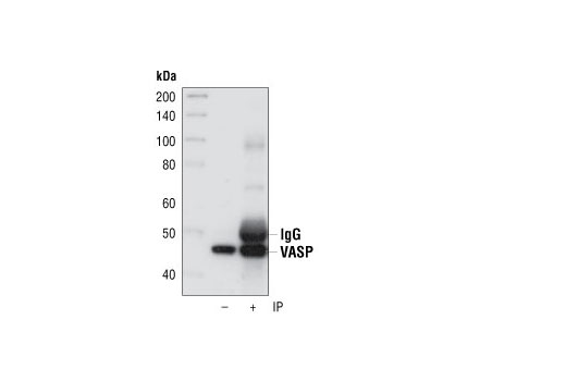  Image 13: Actin Reorganization Antibody Sampler Kit