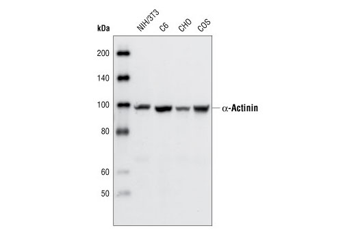 Western Blotting Image 1: α-Actinin Antibody
