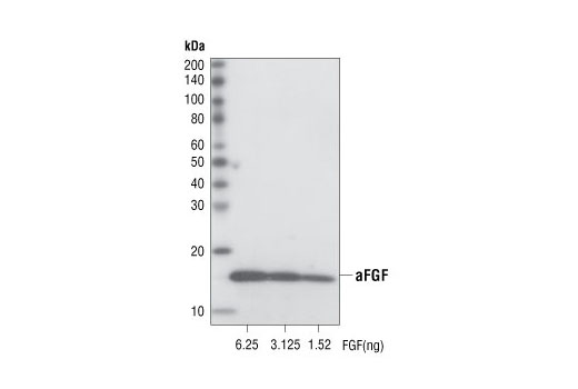 Western Blotting Image 1: Acidic FGF (11H11) Rabbit mAb