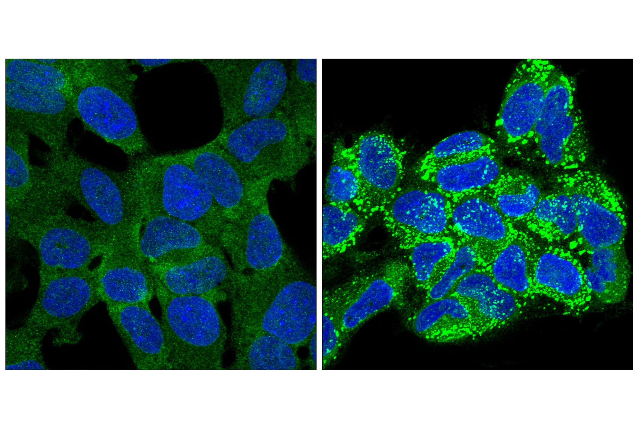 Immunofluorescence Image 1: Transportin-1 (E7X4Z) Rabbit mAb