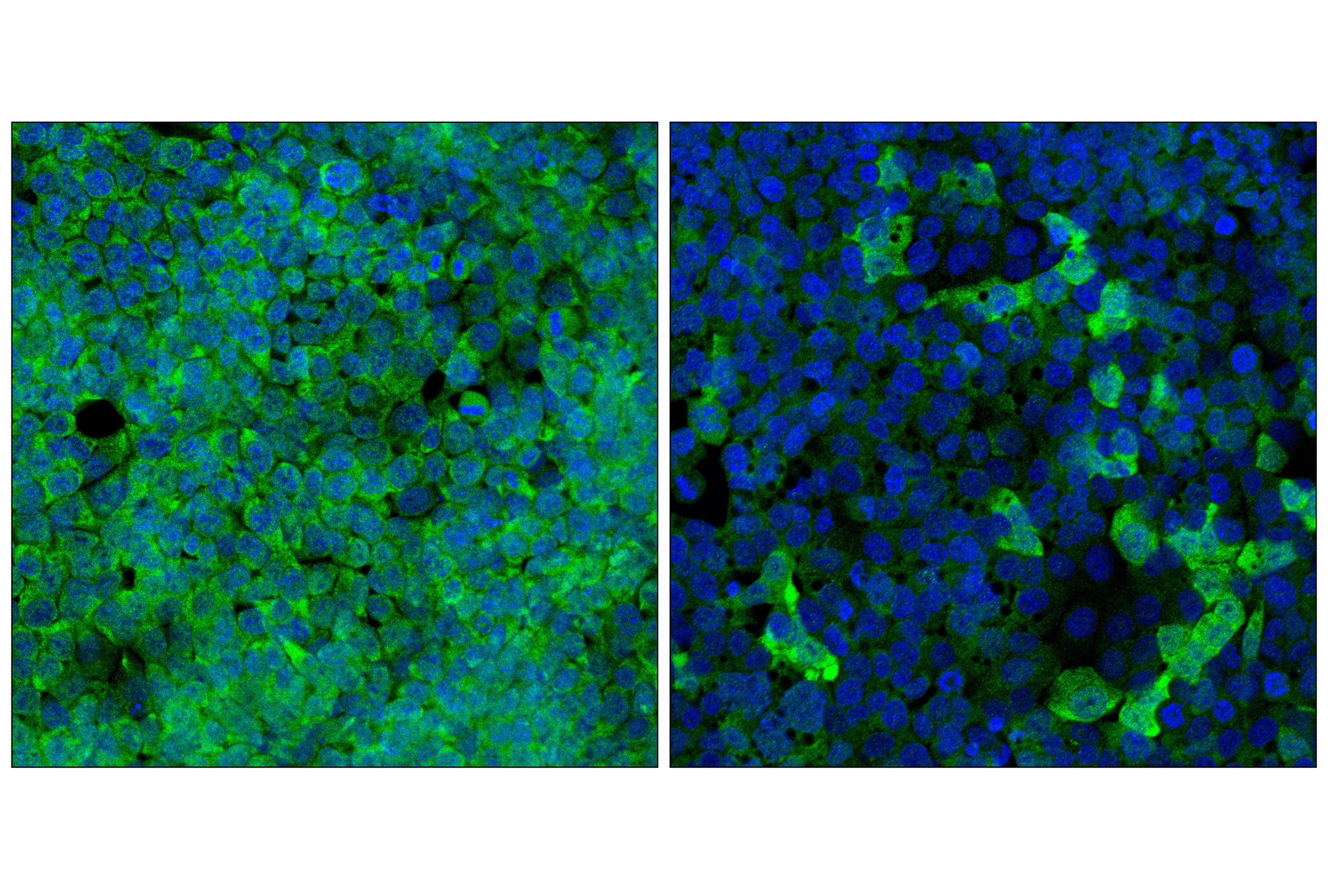 Immunofluorescence Image 2: Transportin-1 (E7X4Z) Rabbit mAb