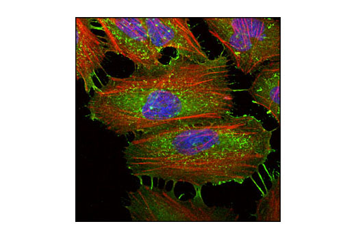 Immunofluorescence Image 1: Ezrin Antibody