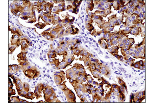 Immunohistochemistry Image 1: NaPi2b/SLC34A2 (D6W2G) Rabbit mAb (BSA and Azide Free)