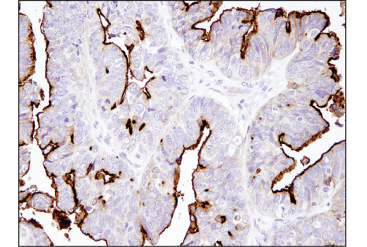 Immunohistochemistry Image 2: NaPi2b/SLC34A2 (D6W2G) Rabbit mAb (BSA and Azide Free)