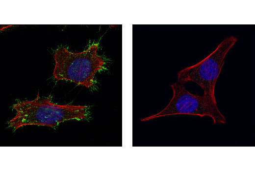 Immunofluorescence Image 1: Moesin (Q480) Antibody