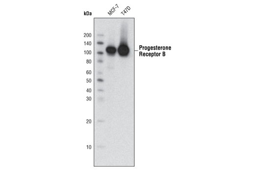 Western Blotting Image 1: Progesterone Receptor B (C1A2) Rabbit mAb (BSA and Azide Free)
