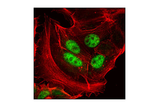 Immunofluorescence Image 1: Progesterone Receptor B (C1A2) Rabbit mAb (BSA and Azide Free)