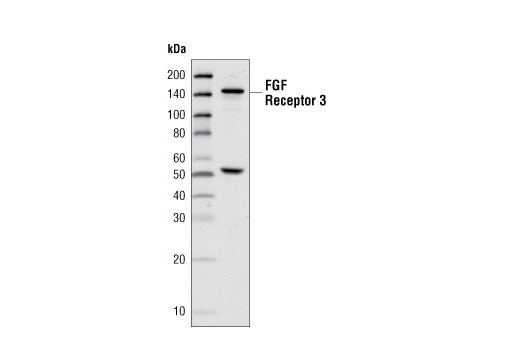 Western Blotting Image 1: FGF Receptor 3 Antibody