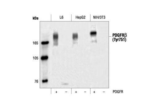 Western Blotting Image 1: Phospho-PDGF Receptor β (Tyr751) Antibody