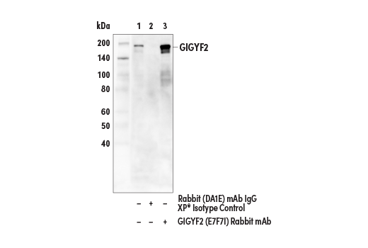 Immunoprecipitation Image 1: GIGYF2 (E7F7I) Rabbit mAb