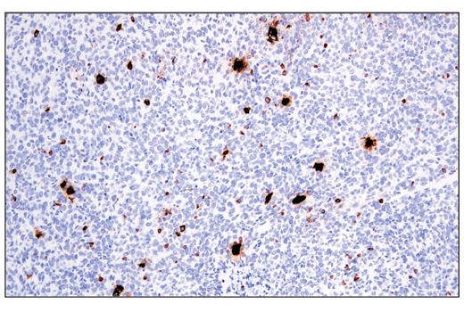 Immunohistochemistry Image 1: Perforin (E3W4I) Rabbit mAb