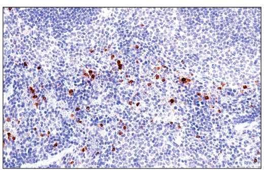 Immunohistochemistry Image 3: Perforin (E3W4I) Rabbit mAb