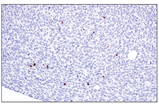 Immunohistochemistry Image 5: Perforin (E3W4I) Rabbit mAb