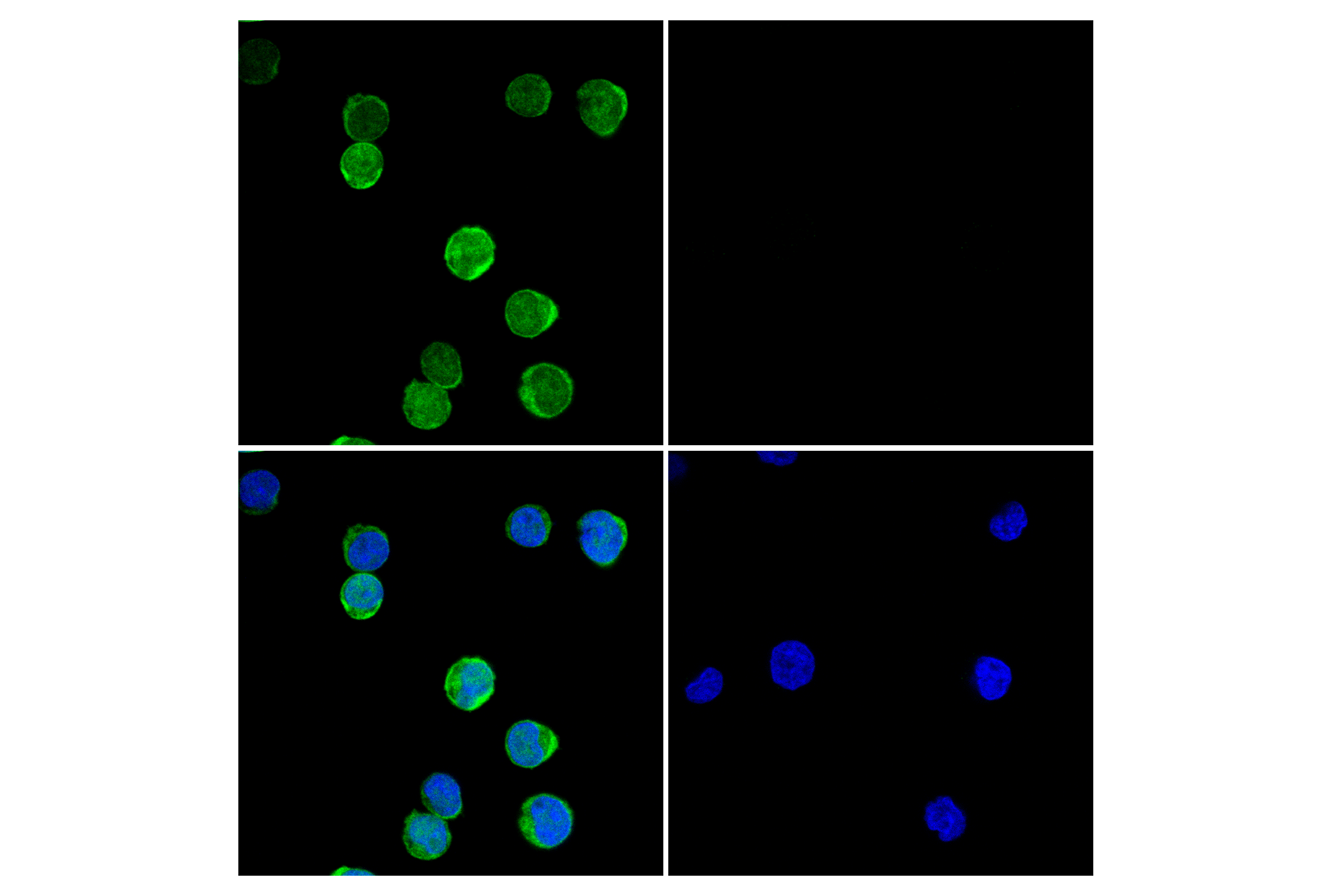 Immunofluorescence Image 1: Zap-70 (D1C10E) XP® Rabbit mAb (BSA and Azide Free)