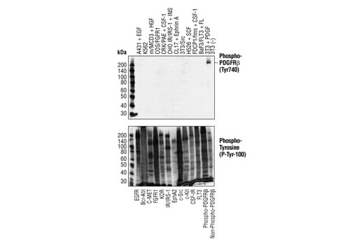  Image 3: PDGF Receptor β Antibody Sampler Kit