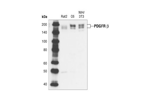  Image 4: PDGF Receptor β Antibody Sampler Kit