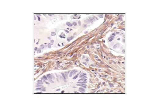  Image 17: Angiogenesis Receptor Tyrosine Kinase Antibody Sampler Kit