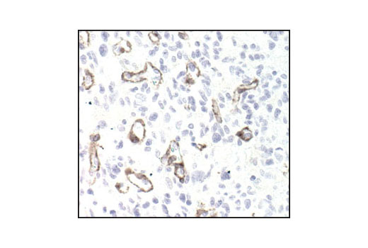  Image 16: Cancer Associated Fibroblast Marker Antibody Sampler Kit